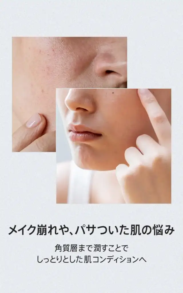 シラカバ70水分ブースティングセラム 30ml 詳細イメージ 2