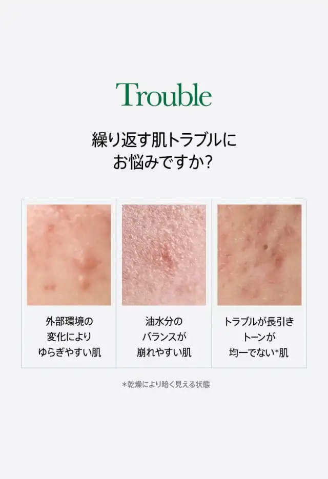 ドクダミセンテラレッドスポットクリーム 30g 詳細イメージ 1