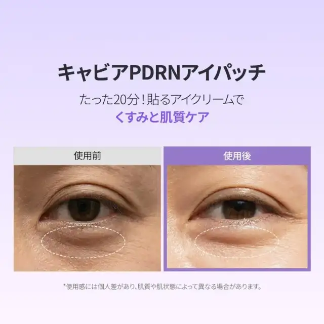 【バイオダンス】キャビアPDRNアイパッチ(60枚入り) ハイドロゲル目元パッチ|目元ケア|口元ケア|クマ|ツヤ|透明感ケア|韓国コスメ 詳細イメージ 3