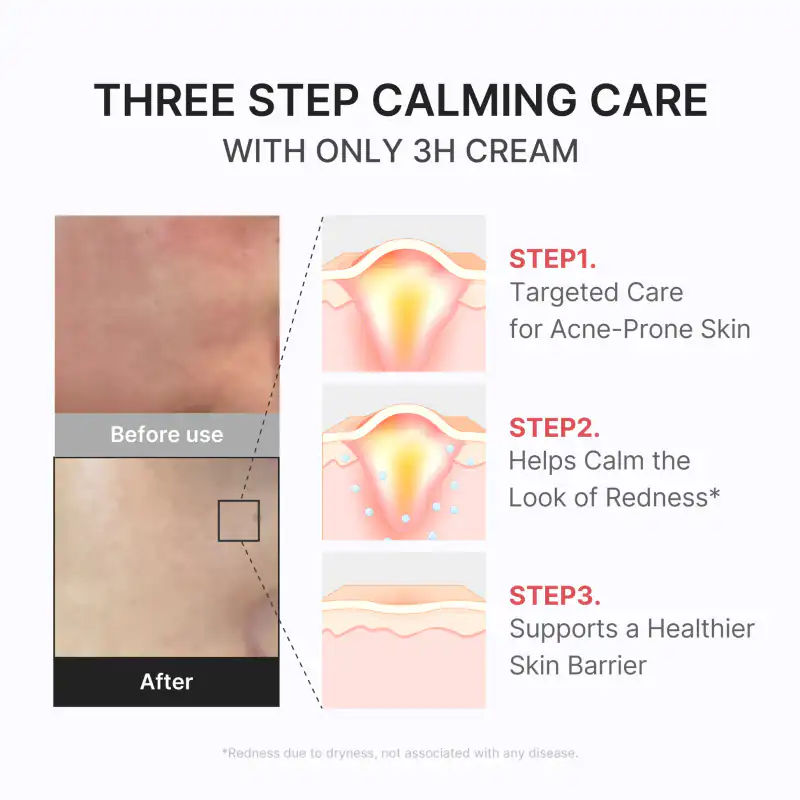 3H Daily Relief Cream 詳細イメージ 5