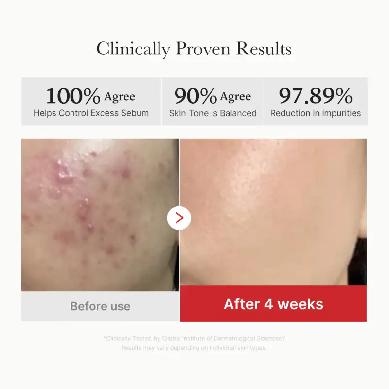 [Subscr.] Red Succinic Acid Panthenol Pads 詳細イメージ 4