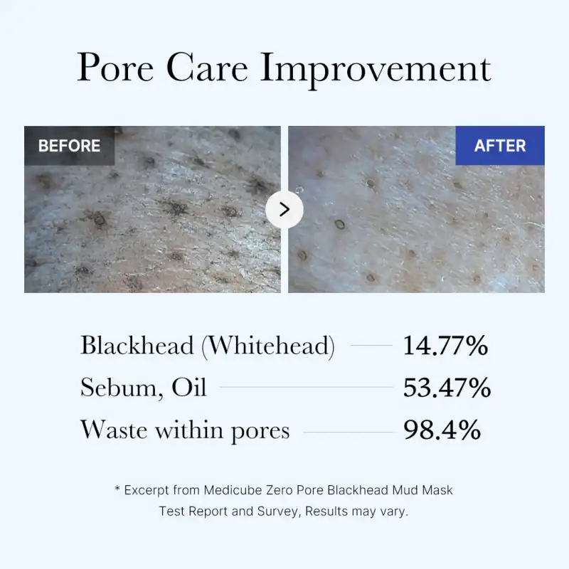 [Subscr.] Zero Pore Blackhead Mud Mask 詳細イメージ 5