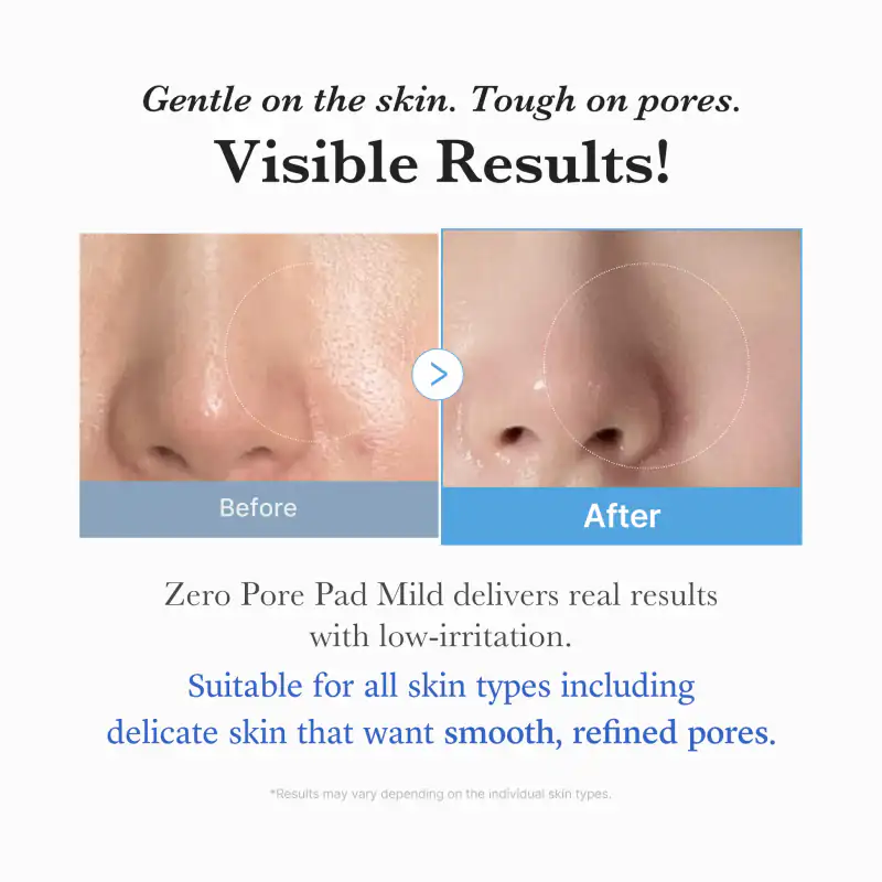 [Subscr.] Zero Pore Madecassoside Pads (Mild) 詳細イメージ 5