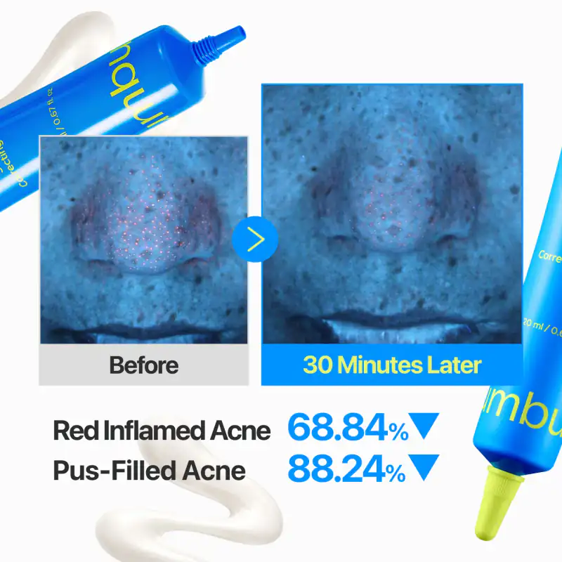 No.0 Zero Blemish 3X Spot Correcting Cream 詳細イメージ 6