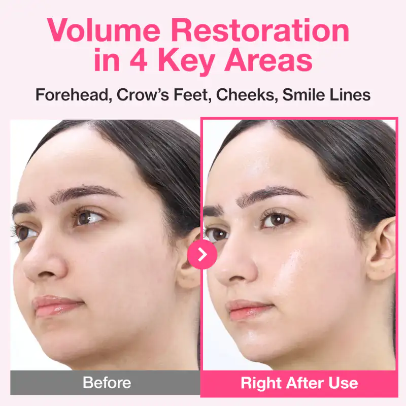 No.2 Rose PDRN Collagen Plumping Sheet Mask (5 Sheets) 詳細イメージ 6