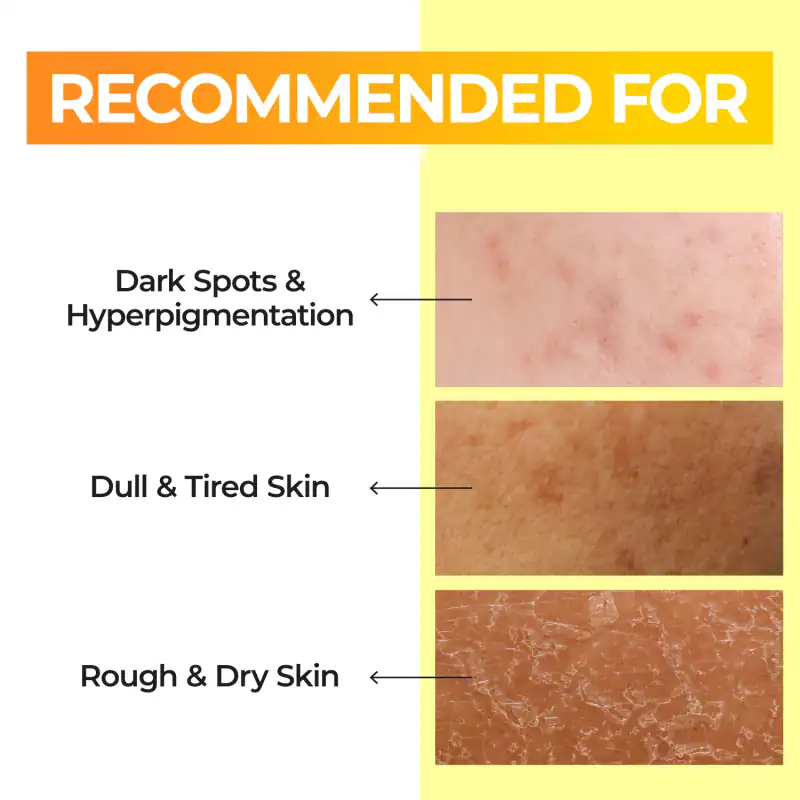 No.5 Dark Spot Brightening Routine (5 items) 詳細イメージ 4